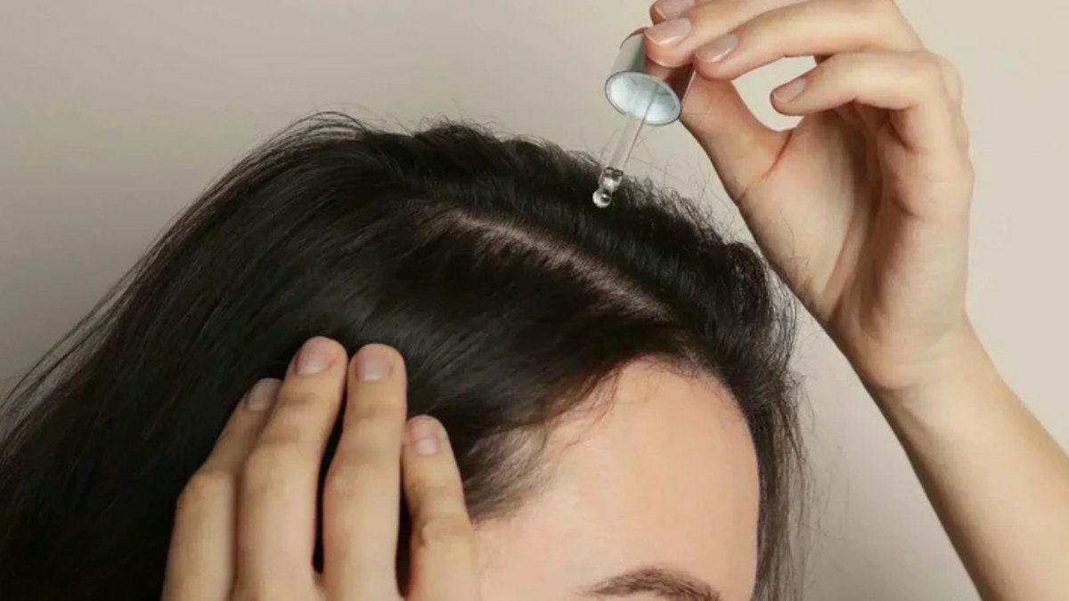 Itchy Scalp Treatment: Causes, Home Care & Scalp Brush Benefits  Dermeleve
