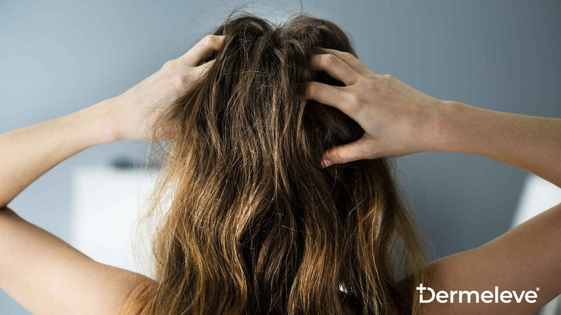Itchy Scalp Featured Image