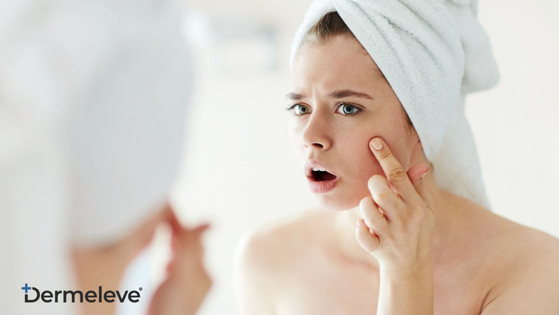 5 Signs You're Experiencing Topical Steroid Withdrawal (TSW)