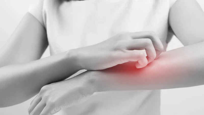 Chronic Pruritus: What Persistent Itching Says About Your Health