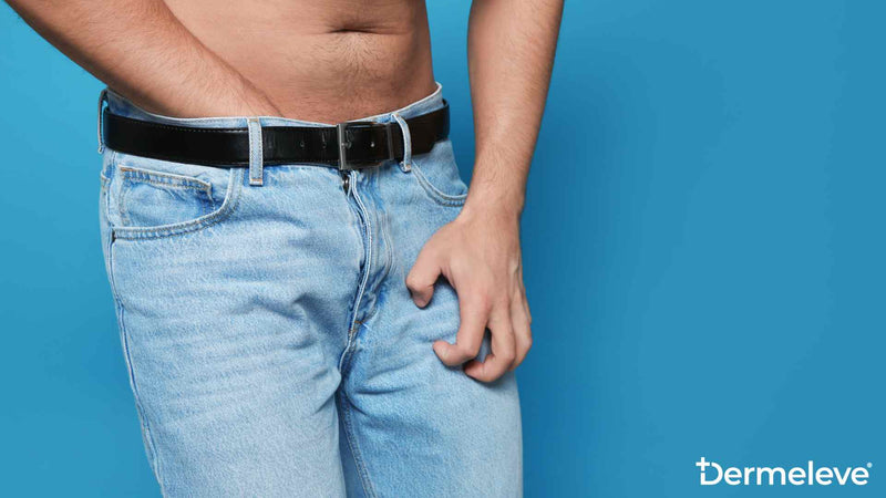 Is Jock Itch Contagious Featured Image