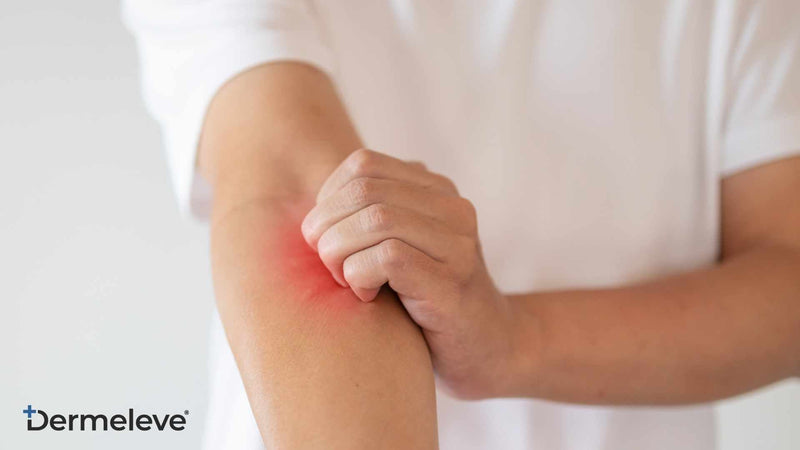 What Does Neuropathic Itch Feel Like? Featured Image