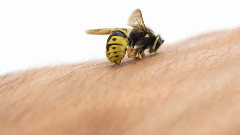 Wasp Sting Swelling After 48 Hours: Is It Normal?