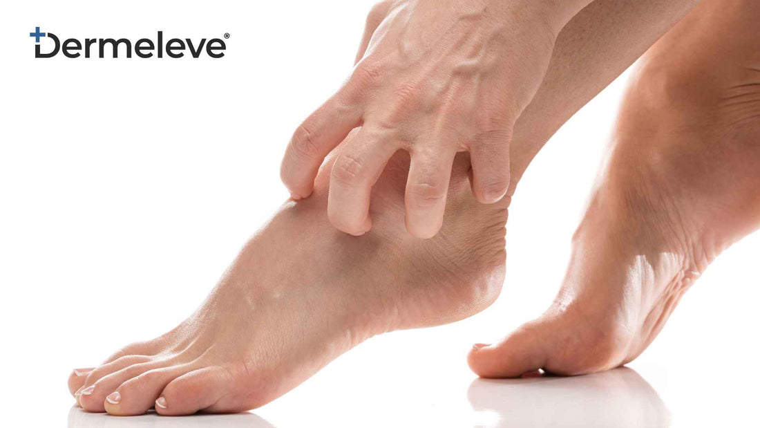 Why Are My Feet Itching Like Crazy? - Featured Image
