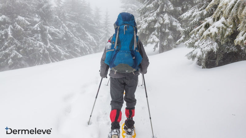 How To Prevent And Treat A Winter Rash On Your Hands - featured image