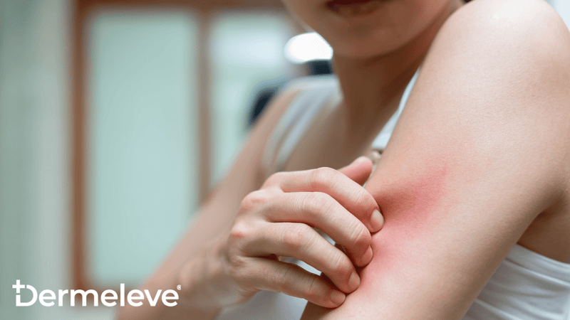 The Risks of Topical Corticosteroid Therapy and Safer Treatment for Inflammatory Skin Diseases