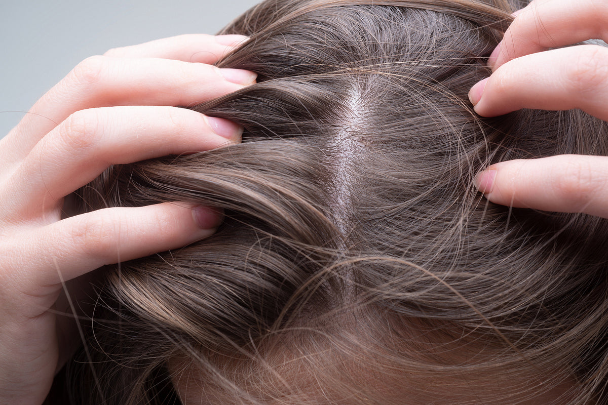Scalp Psoriasis Treatment
